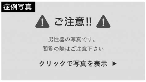 【泌尿器科の医師が解説】亀頭を大きくする4つの方。